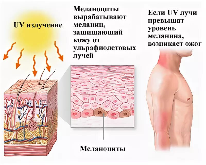 витилинг. меланоциты располагаются в слое кожи. пигменты в организме человека. пигменты в организме человека. меланоциты меланин кожа.