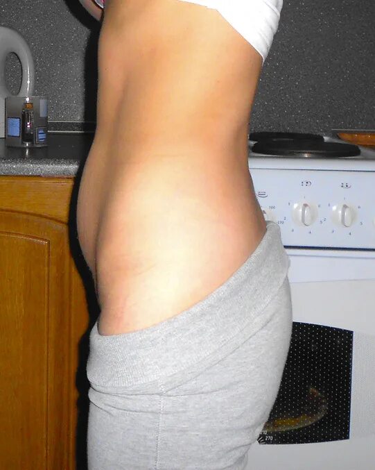 вздутие низа живота у женщин. вздутие низа живота у женщин. выпирающий живот. вздутие низа живота у женщин. животик внизу живота.