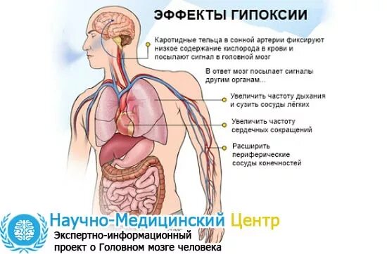 Гипоксия. Старческая гипоксия. Гипоксическая гипоксия. Гипоксические изменения мозга