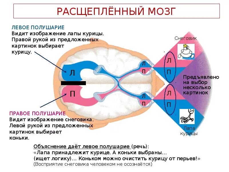 Синдром расщепленного мозга. Модель расщепленного мозга. Операция по расщеплению мозга. Левое и правое полушарие мозга.