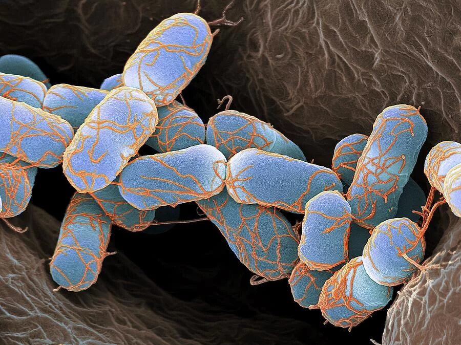 Живые бактерии название. Бактерия Escherichia coli. E coli электронная микроскопия. Escherichia coli в микроскопе. Escherichia coli электронная микроскопия.