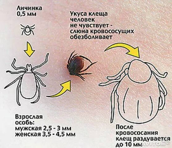 При присасывании клеща симптомы. Как выглядит место укусом клеща клеща. Когда вылезают клещи