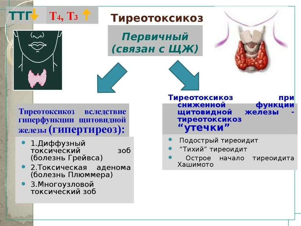 Тиреотоксический зоб. Тиреотоксикоз щитовидной. Гипертиреоз симптомы зоб. Тиреотоксикоз щитовидной железы классификация. Тиреотоксический синдром симптомы.