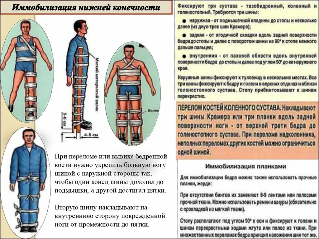 Шина для транспортной иммобилизации при переломе бедра. Транспортная иммобилизация бедренной кости. Иммобилизация нижнейиконечности. Транспортная иммобилизация при переломе нижней конечности.