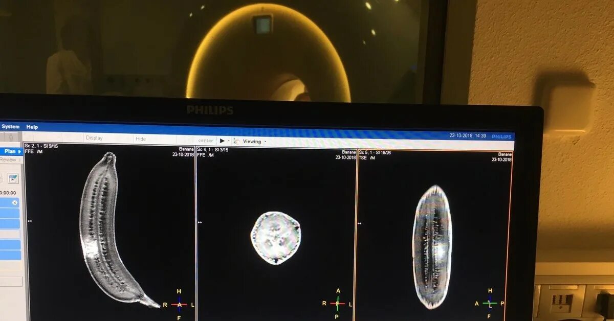 Чем отличается узи от мрт. Банан мрт кт рентген. Банан мрт кт рентген УЗИ. Кт мрт УЗИ рентген. Разница кт мрт банан.