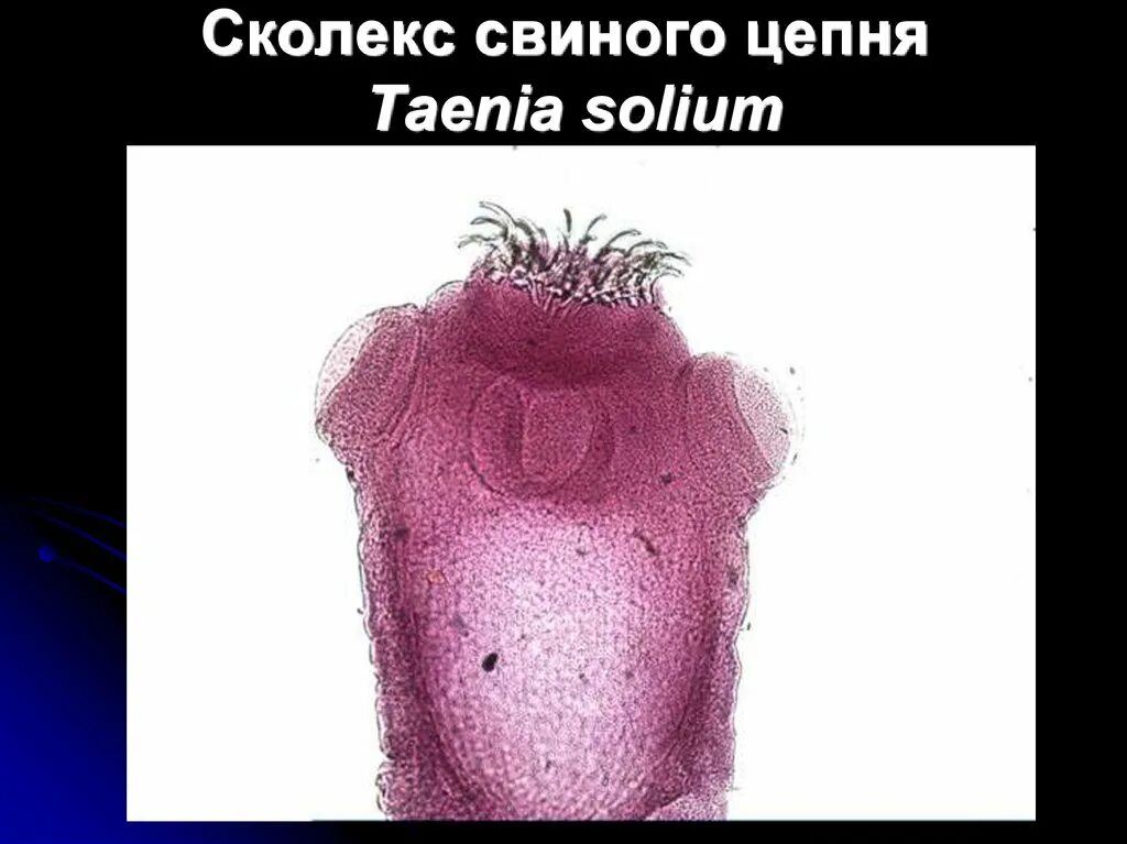 Сколекс бычьего цепня. Бычий цепень сколекс препарат. сколекс свиного цепня препарат. сколекс бычьего цепня микроскоп.