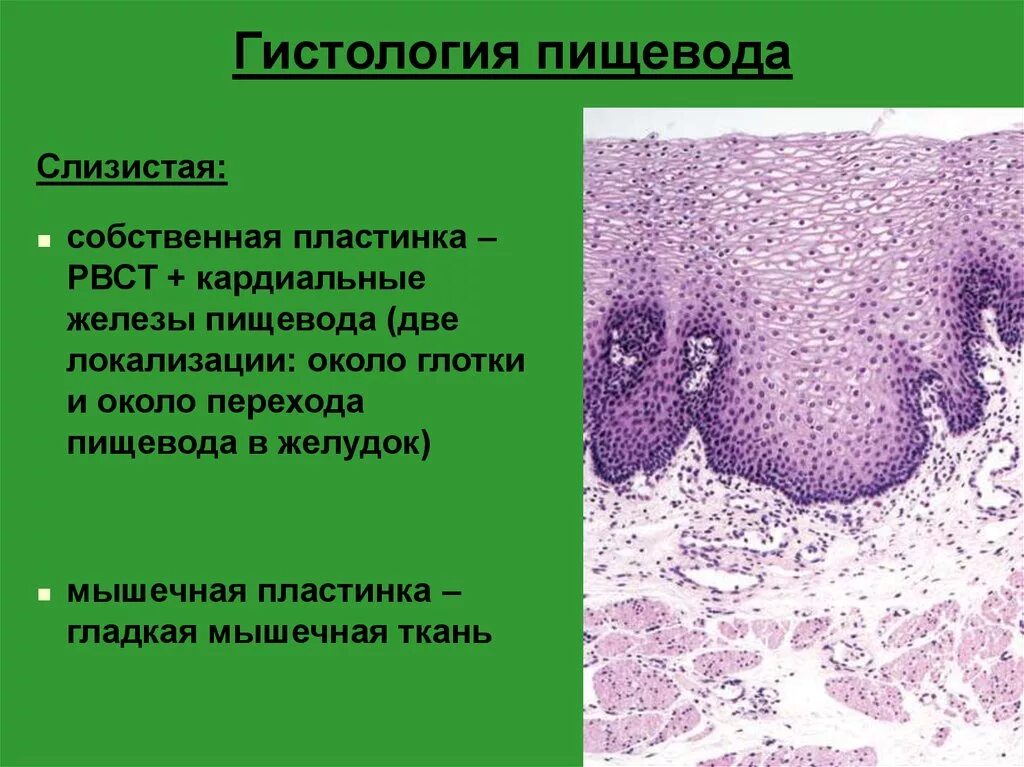 Клетки пищевода. Многослойный плоский неороговевающий эпителий пищевода гистология. Многослойный плоский неороговевающий эпителий пищевода препарат. Слизистая оболочка пищевода препарат. Многомлойный плоский неорогевпющий эпителий Мрез пищевода.