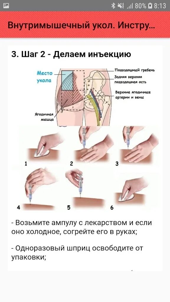 Уколы внутримышечно инструкция. Схема внутримышечного укола. Как делать внутримышечный укол. Схема уколов внутримышечно в ягодицу.