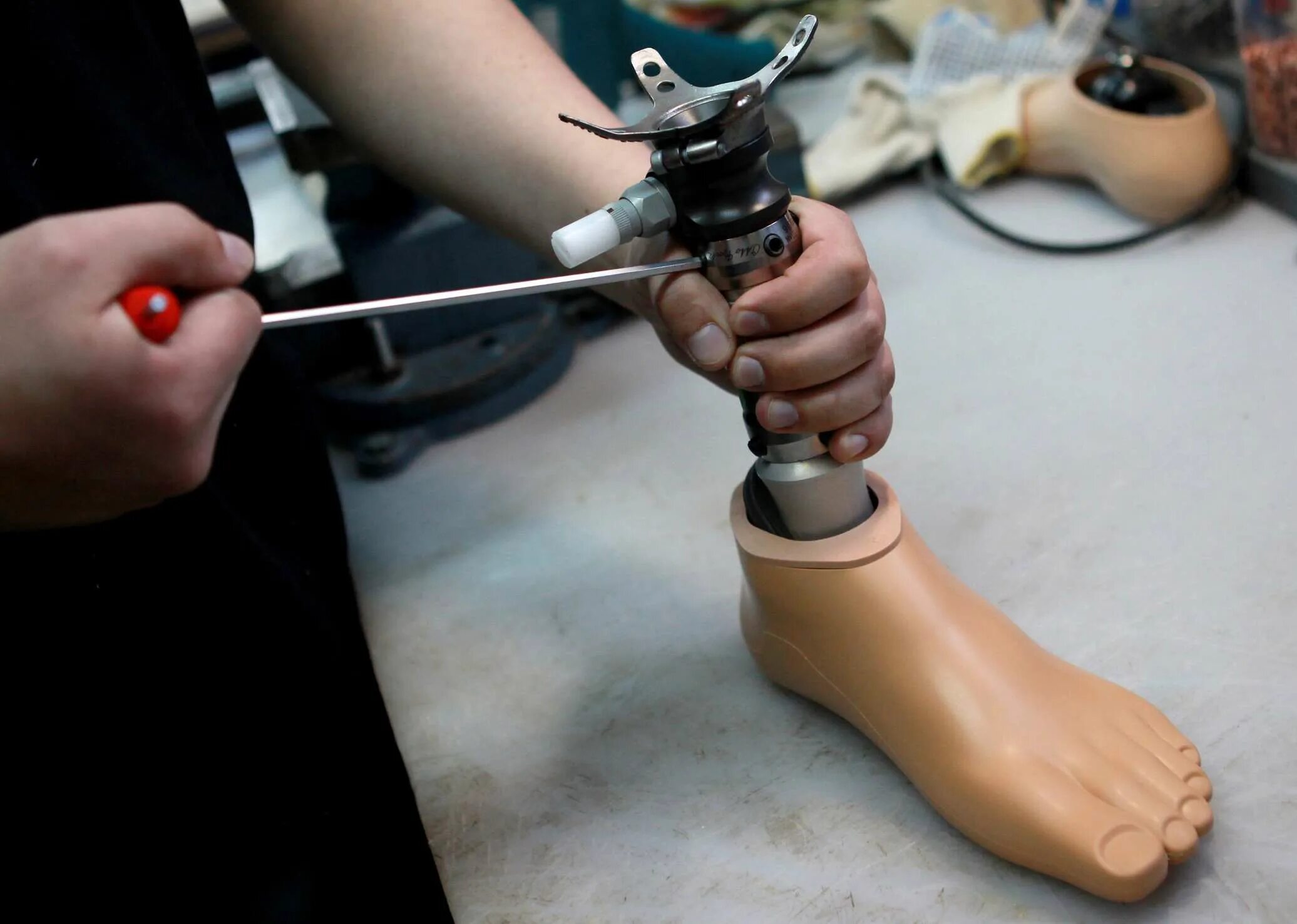 Протезист конечностей. Протез руки. Современные протезы ног. Ножные протезы для инвалидов. Протезы нижних конечностей.