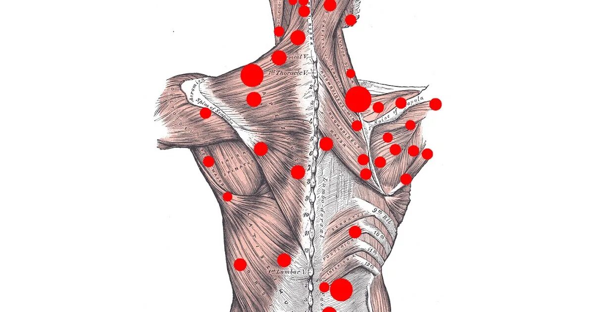 Триггерные точки поясницы. Триггерные точки шейно грудной отдел. Триггерные точки вдоль позвоночника. Триггерные точки грудного отдела. Триггерные точки на теле человека массаж.