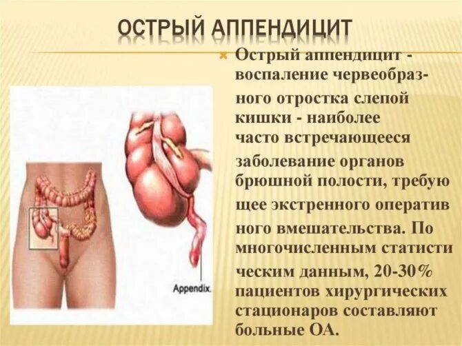 Полость вызывать