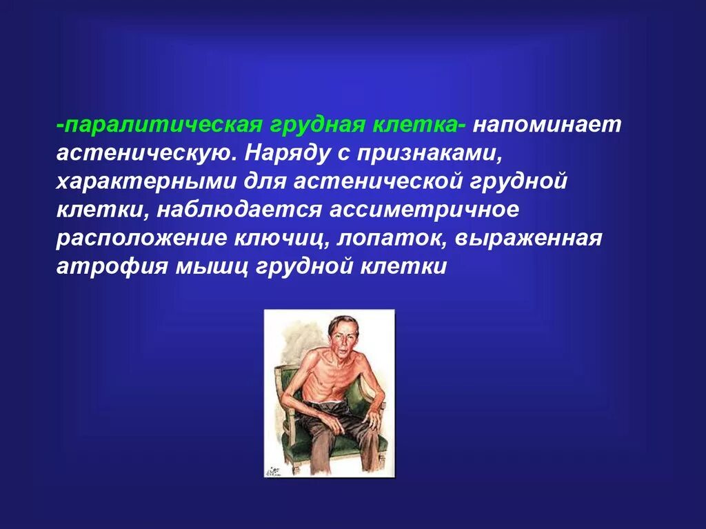 У спортсменов чаще наблюдается форма грудной клетки. У спортсменов чаще наблюдается форма грудной клетки