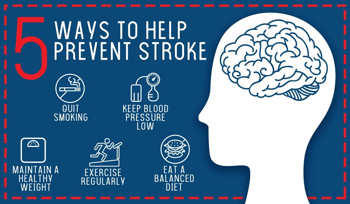 How to stroke. Prevent. stroke. to prevent. stroke symptoms.
