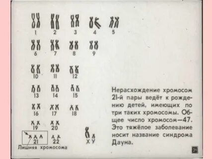 Лишняя хромосома