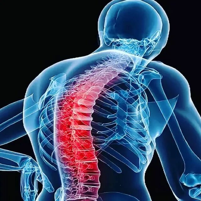 Болезнь бехтерева какой врач. Болезнь бехтерева какой врач. Болезнь бехтерева поражение суставов. Периферическая форма болезни бехтерева. Болезнь бехтерева симптомы.