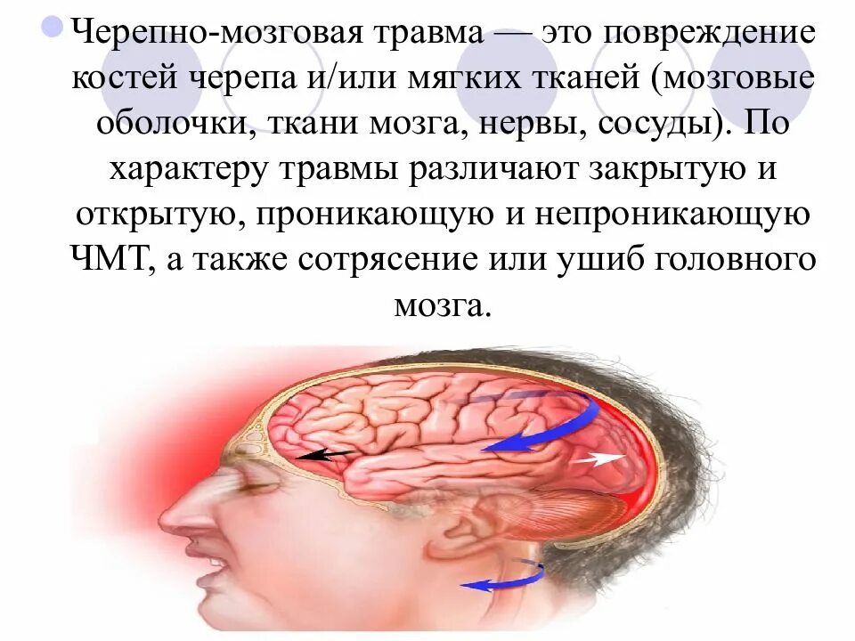 Тяжелые травмы головного мозга. Черепно-мозговая травма. Черпномозговая травма. Черепно мозговая трамв. Закрытая черепно-мозговая травма.