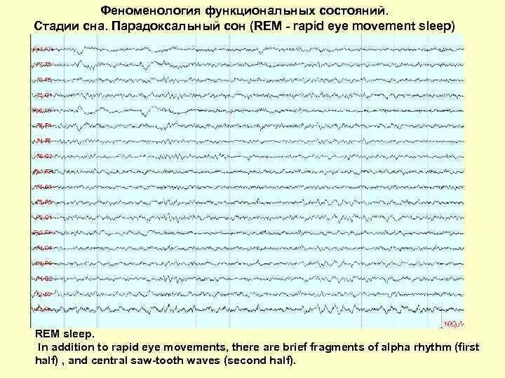 Rem фаза сна ЭЭГ. Rem стадия сна. Парадоксальная стадия сна. ЭЭГ парадоксального сна.
