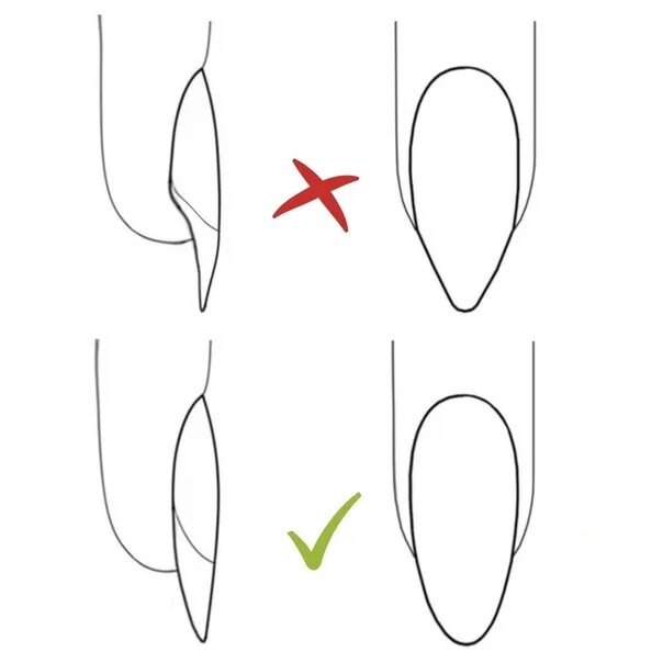 Как выпилить форму ногтей. Опил формы миндаль схема. Форма ногтей миндаль схема опила. Схема опила формы ногтей овал. Опил формы ногтей миндаль.