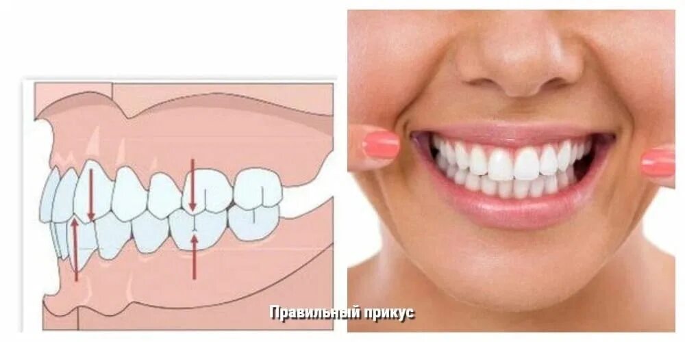 Ортогнатический прикус резцы. Зубы нижней челюсти нормальный прикус. Правильный прикус зубов у человека схема. Ортогнатический прикус дистальный прикус.