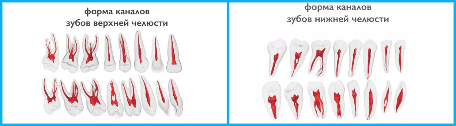 Строение каналов зубов верхняя челюсть. Сколько корневых каналов в зубе 75. Зубы нижней челюсти анатомия корневых каналов. Анатомия корневых каналов 25 зуба.