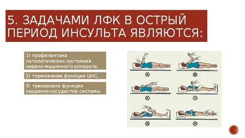 Инсульт упражнения для правой руки