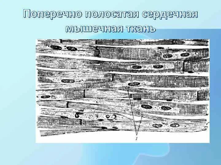 Выберите два изображения сердечной поперечнополосатой мышечной ткани. Поперечно-полосатая сердечная мышечная ткань кардиомиоциты. сердечная поперечно-полосатая мышечная ткань рисунок. рисунок поперечно полосатой сердечной мышечной ткани. поперечно-полосатая сердечная мышечная ткань млекопитающих.