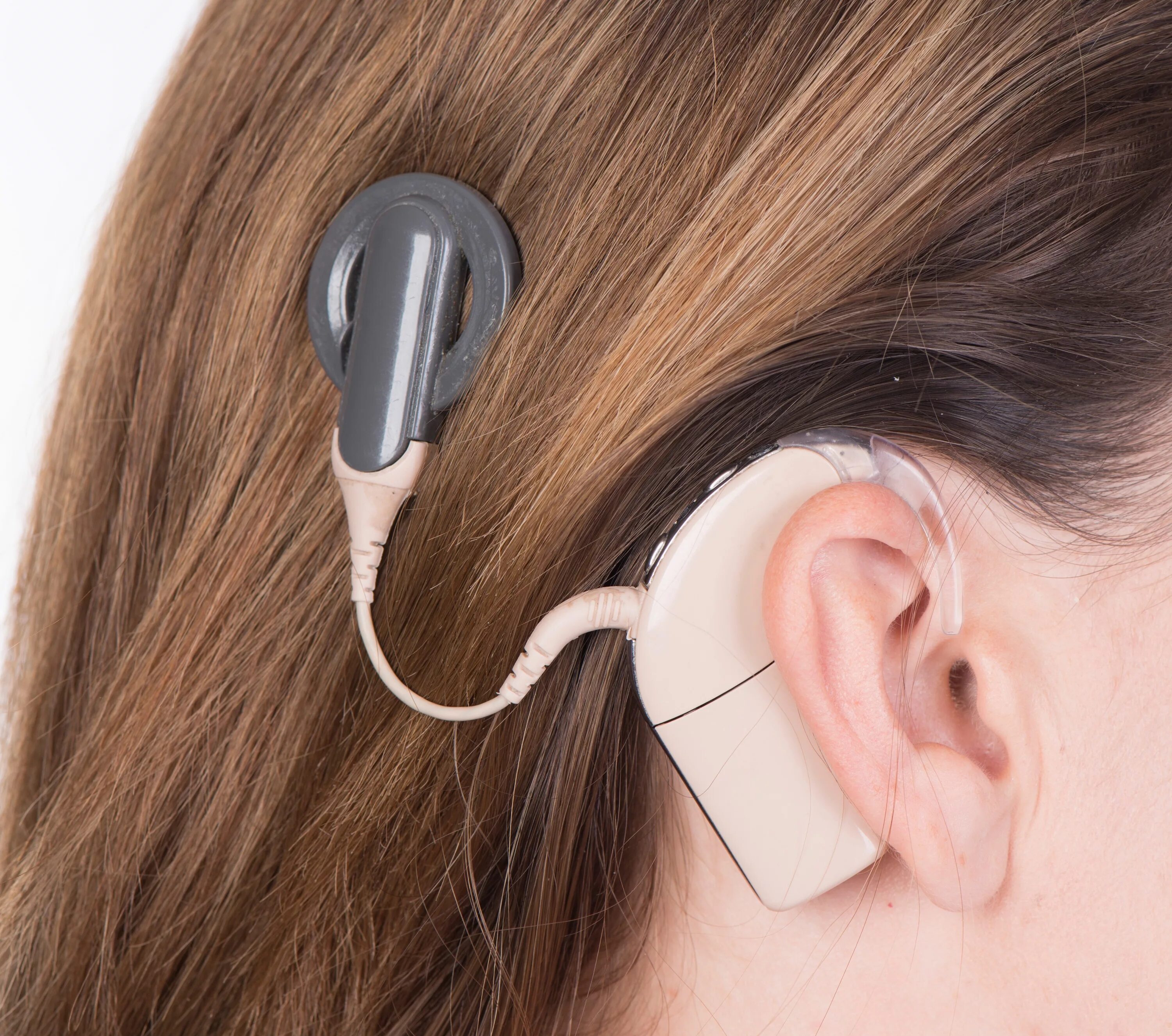Аппарат Cochlear кохлеарный. Слуховой аппарат кохлеарный имплант. Кохлеарный имплант Кохлер. Аппарат для глухих кохлеарная имплантация.
