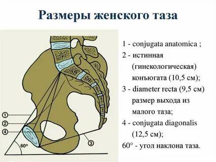 Прямой размер плоскости входа в малый таз
