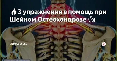 Обострение шейного