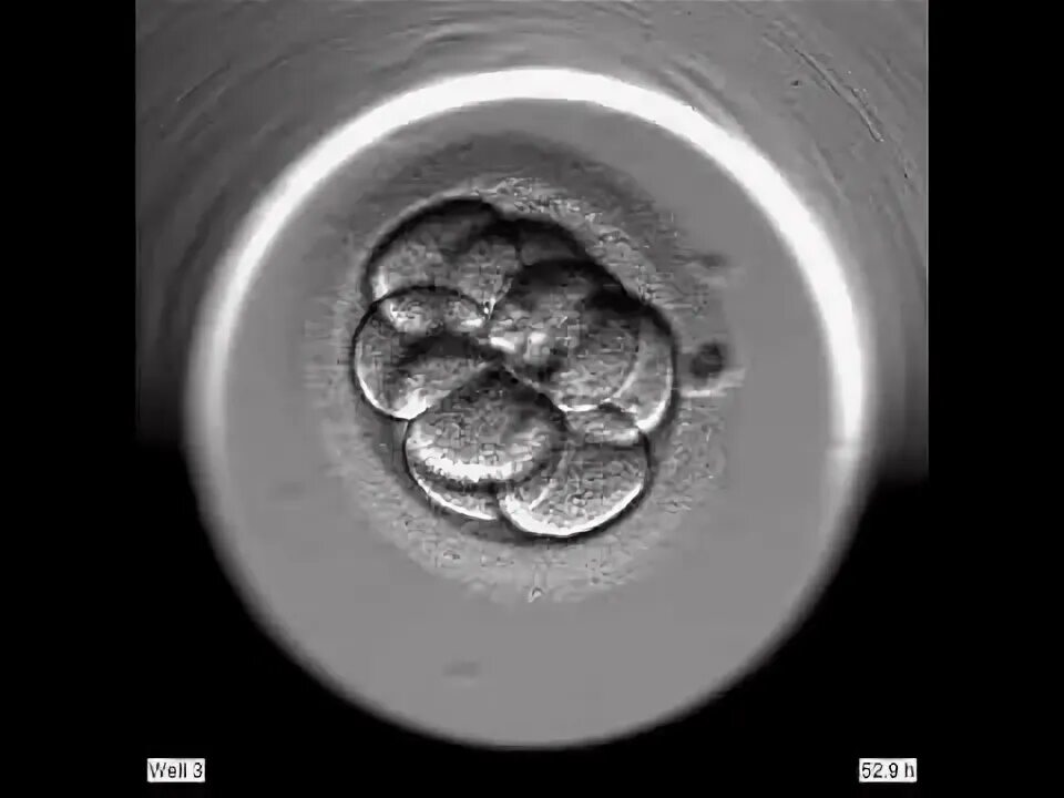 Эмбриоскоп. Бластоциста эмбриоскоп. Эмбрион разделился на 2 при эко. Эмбриоскоп фото. Эмбриоскоп форум.