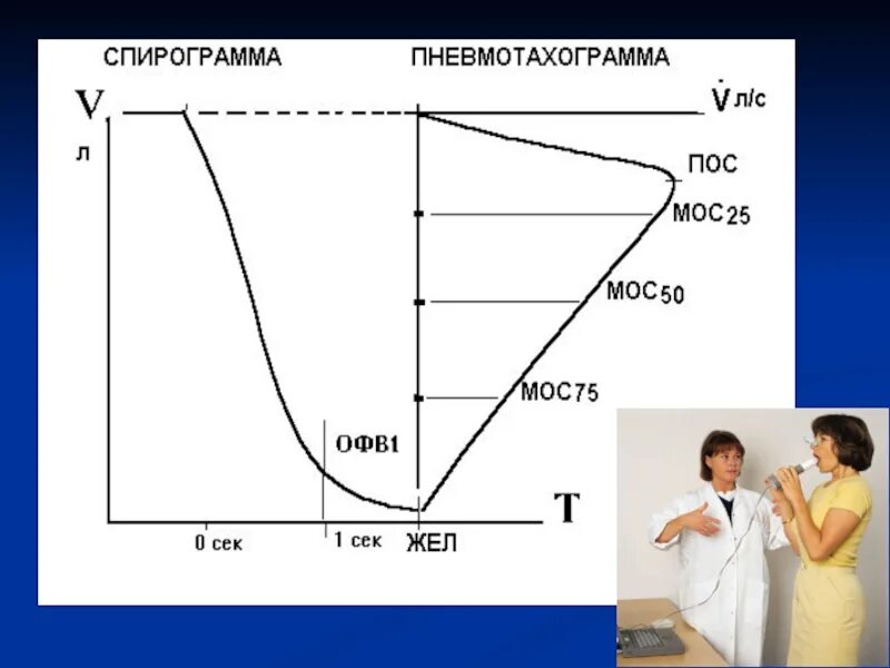 Спирограмма легких. Спирограмма. спирограмма и спирография. спирография жел. пневмотахограмма.