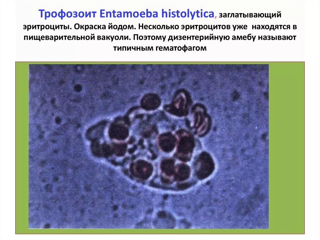 Эритроцит амеба. Трофозоиты entamoeba histolytica. entamoeba histolytica эритроцит. трофозоиты дизентерийной амебы. дизентерийная амёба с эритроцитами.