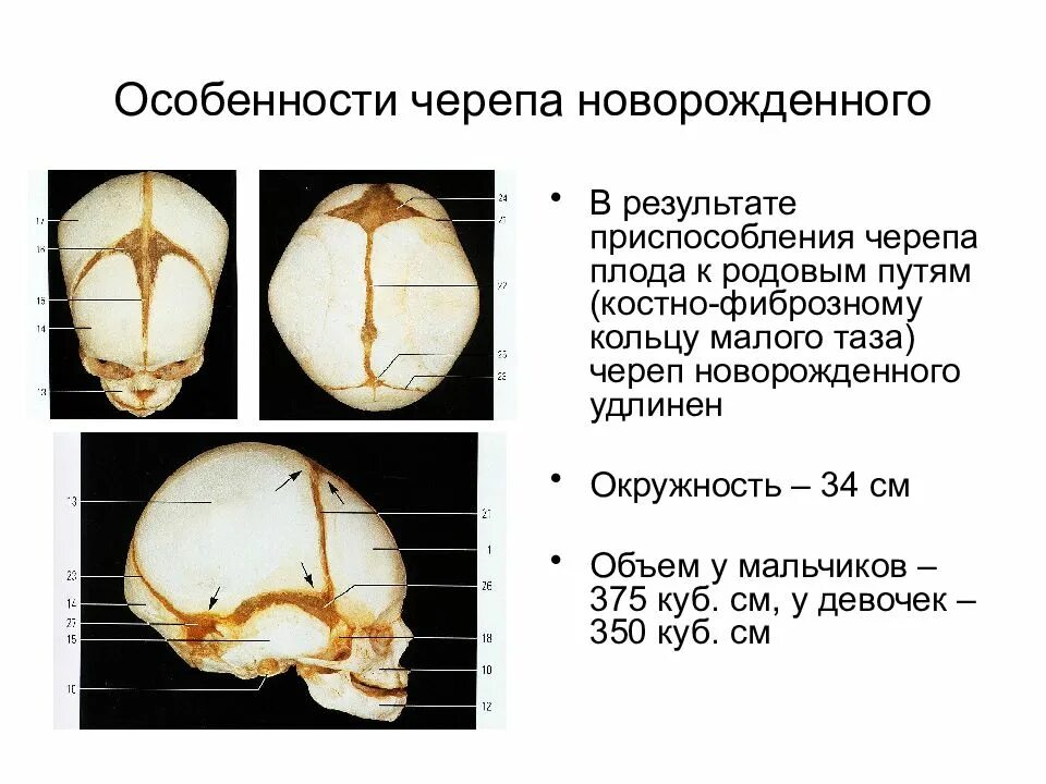 Швы и роднички черепа анатомия. Роднички черепа анатомия. Особенности строения черепа у новорожденных. Роднички новорожденного анатомия черепа. Значение родничков в черепе