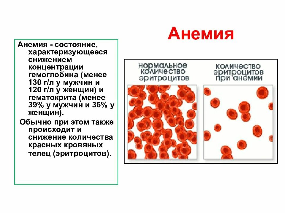 Какой гемоглобин при анемии. Месячные при железодефицитной анемии. низкий гемоглобин анемия. анемия это состояние характеризующееся. признаки падения гемоглобина.