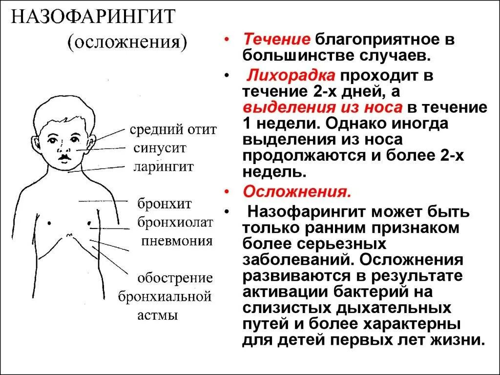 Симптомы острого назофарингита у детей. Клинические симптомы назофарингита у детей. Назофарингит осложнения у детей. Ринофарингит осложнения у детей.