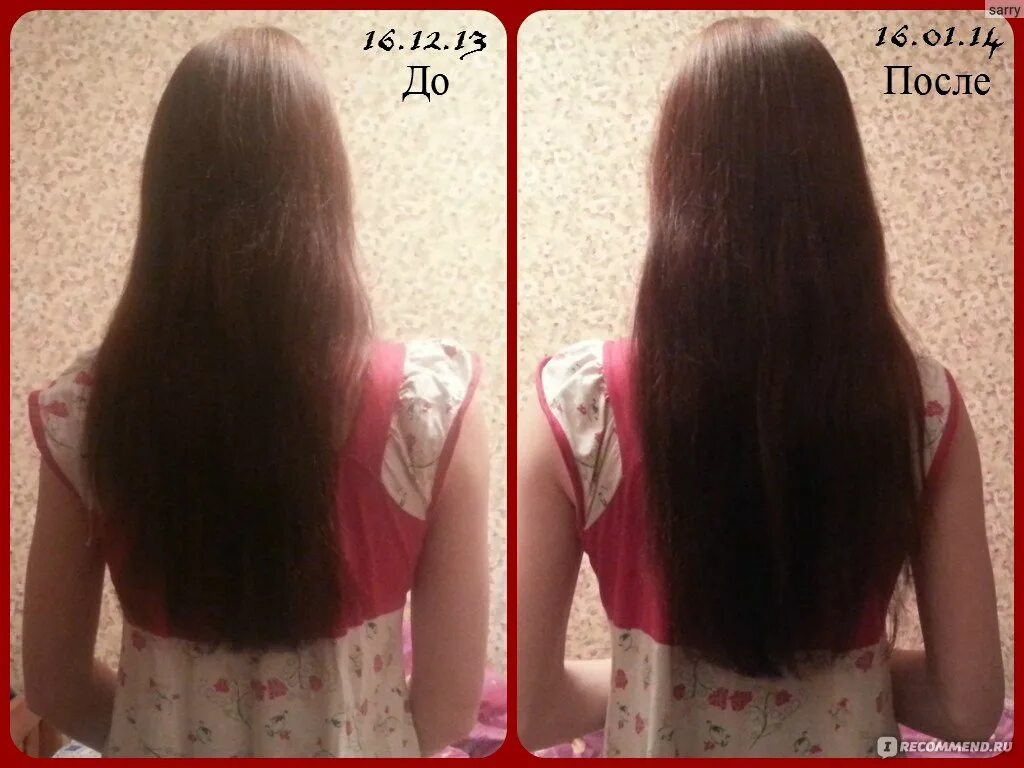 Алерана для роста волос до и после. Алерана спрей до и после. Витамины для роста волос до и после. Алерана спрей дл после. Irecommend волосы