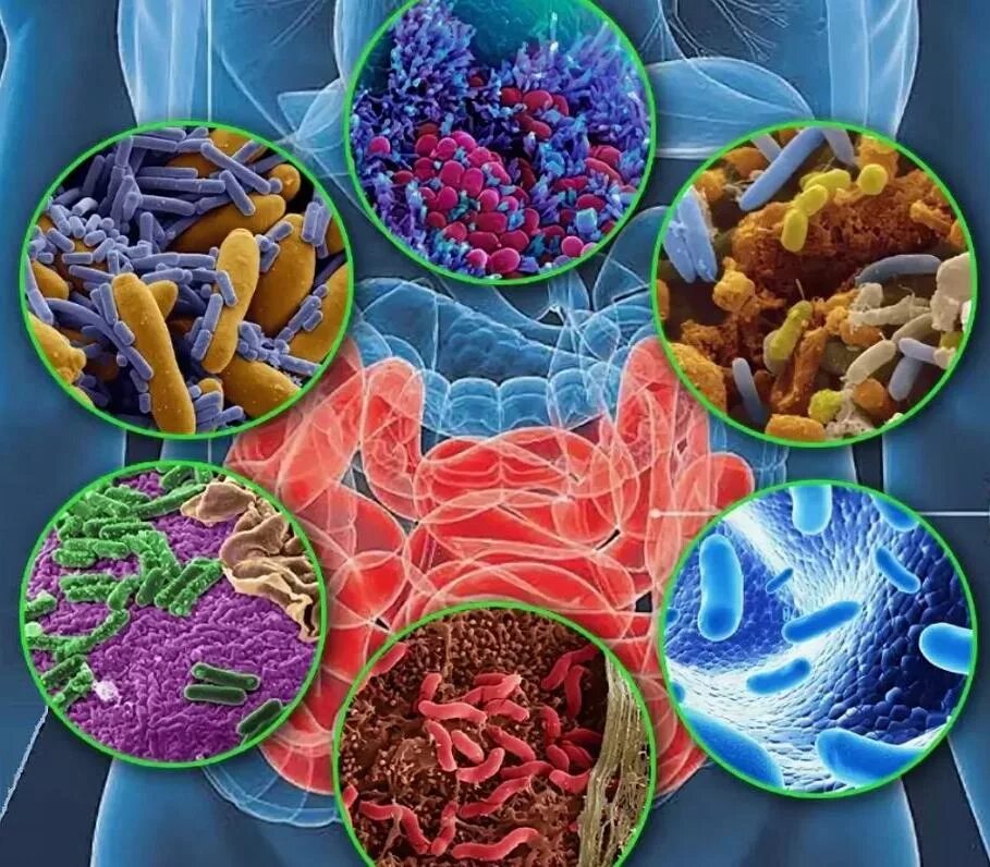 Микробиом (микробиота). Микробиом это в микробиологии. Микрофлора микробиом микробиота. Дисбактериоз кишечника бактерии.