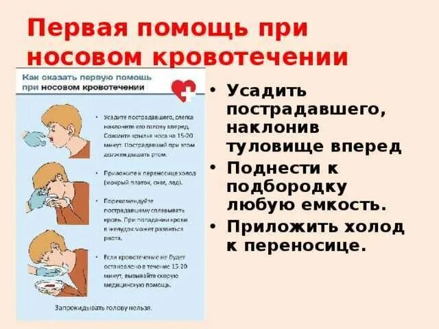 Носовые кровотечения у детей могут возникать. Правила оказания медицинской помощи при носовом кровотечении. Оказание первой помощи пострадавшему при кровотечении из носа. Оказание ПМП при носовом кровотечении. Первая помощь при носовом крово.