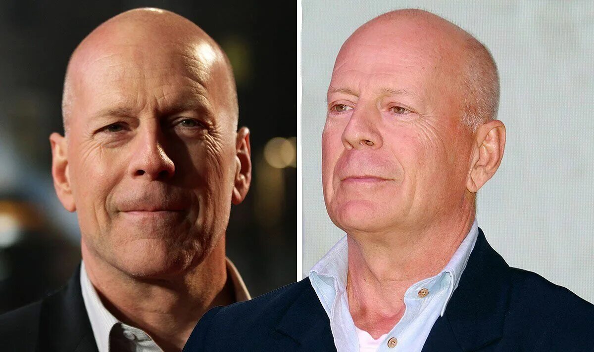 Брюс Уиллис. Bruce Willis сейчас. Брюс Уиллис сейчас деменция. Брюс Уиллис болезнь. Брюс уиллис здоровье сейчас