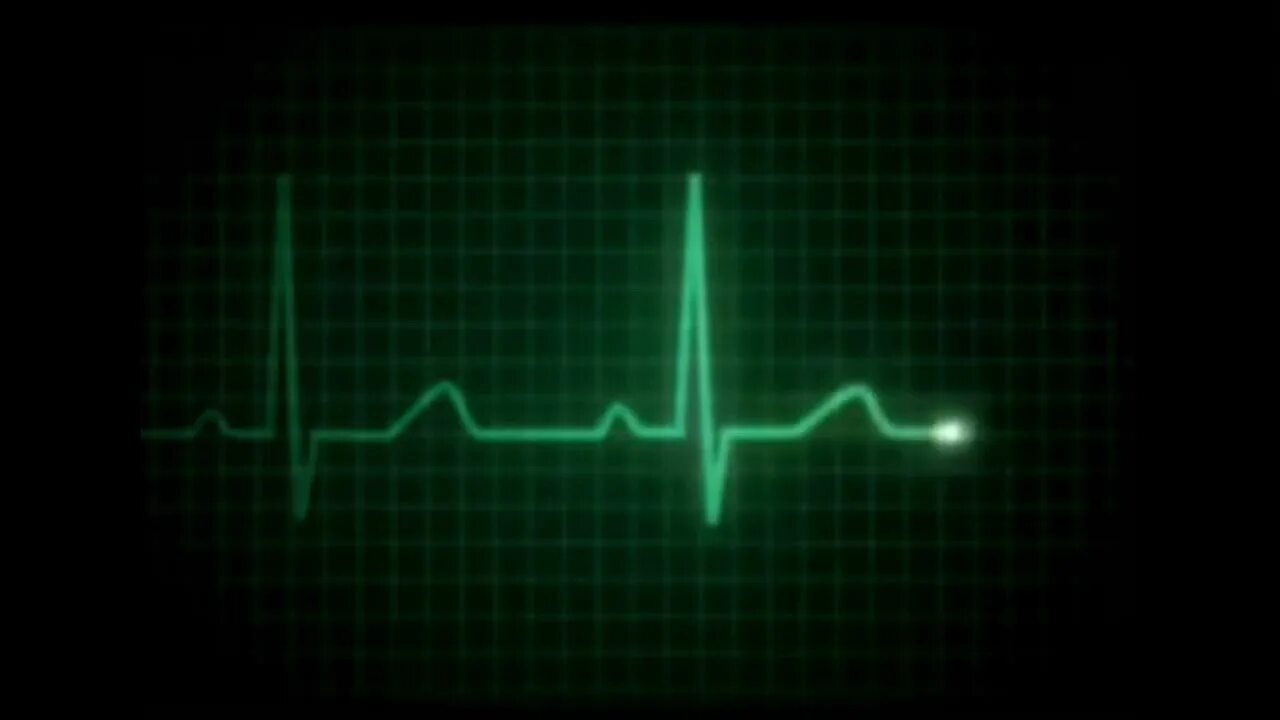 Пульс остановился. Кардиограмма остановки сердца гиф. Кардилграммаостановка сердца. Остановка сердца на ЭКГ. Прямая линия на кардиограмме.