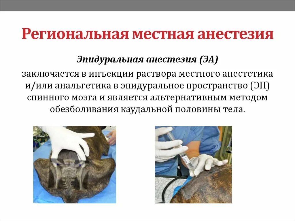 Что такое местный наркоз