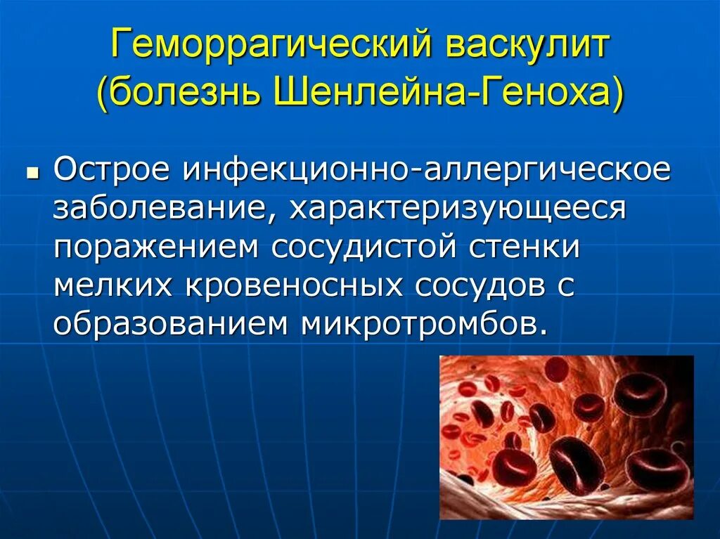 Системные васкулиты клинические. Геморрагический васкулит. Болезнь Шенлейн Геноха. Геморрарпгическийваскулит.