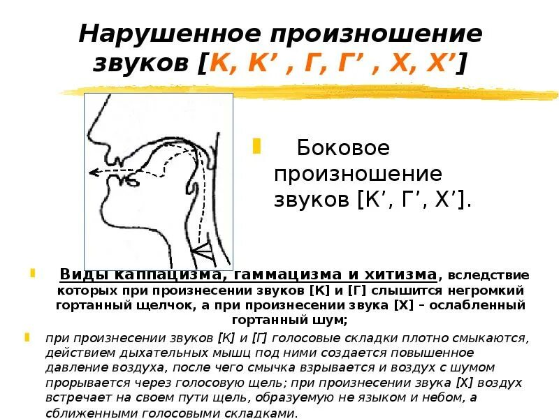 Нарушено произношение звуков. Произношение звуков. Нарушение произношения звуков. Нарушение произношения звука г. Произношение звука г.