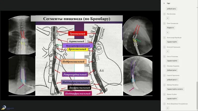 Лучевая пищевода. Сегменты пищевода. Сегменты пищевода по Бромбару. Рентгенологические сегменты пищевода. Поддиафрагмальный сегмент пищевода.