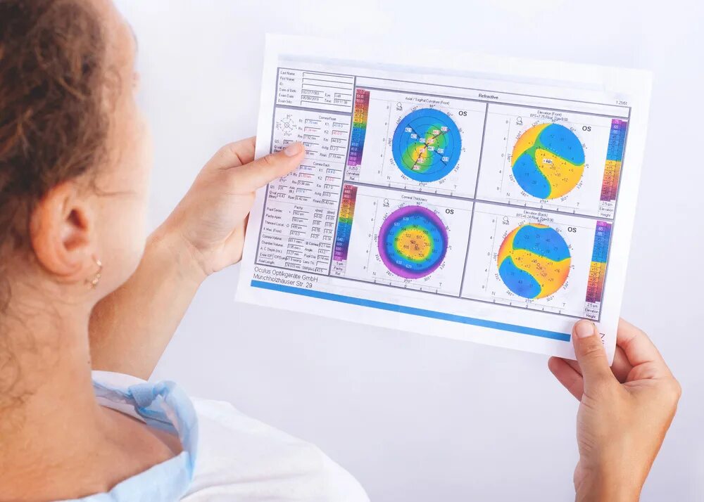 Кератотопограф. Пупиллометрия. Кератоконус кросслинкинг. Кератотопограф картинки. Глазной центр clinicaspectr ru