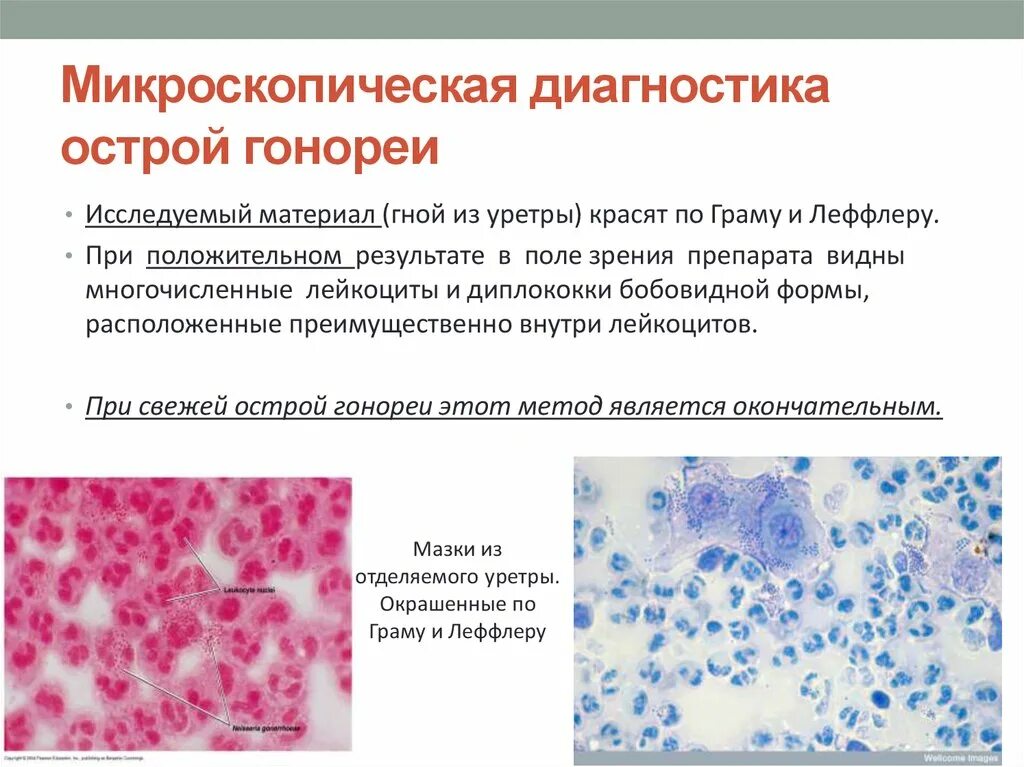 Выделения при иппп
