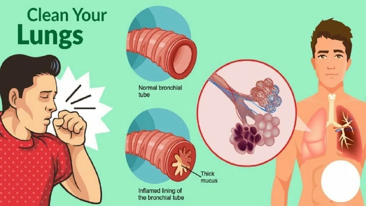 Убрать мокроту в домашних условиях