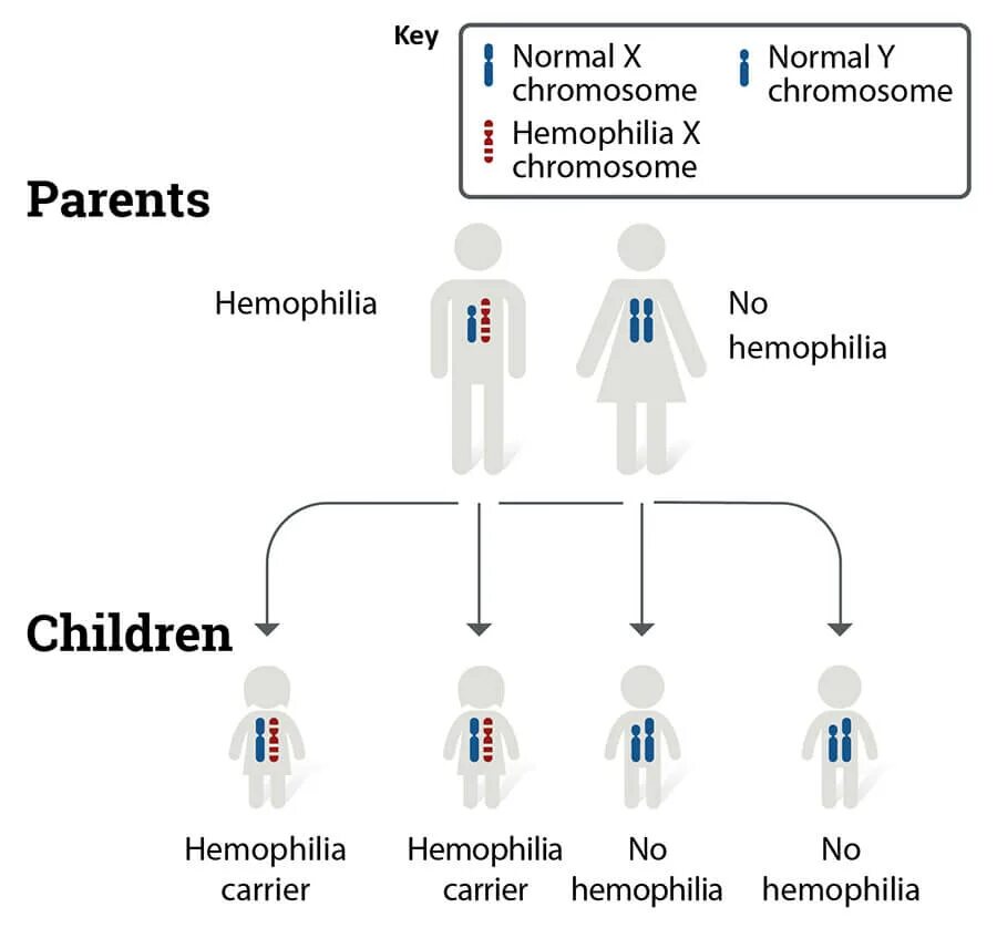 Гемофилия таблица. Гемофилия классификация. Степени гемофилии. Гемофилия у детей классификация.