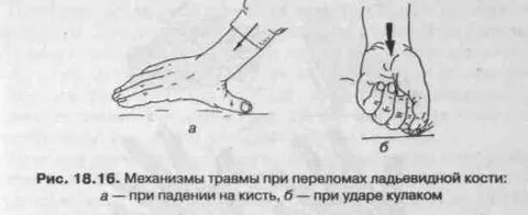 Упал на кисть