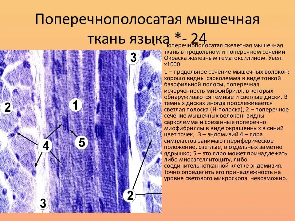 Поперечнополосатая Скелетная мышечная ткань гистология. Поперечно-полосатая Скелетная мышечная ткань препарат. Поперечно полосатая Скелетная ткань гистология. Поперечно полосатая мышечная ткань ящыкакролика. Препарат поперечно полосатая мышечная ткань